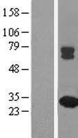 MMAB Human Over-expression Lysates NM_052845