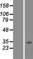 SNAI3 Human Over-expression Lysates NM_178310