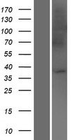 UBAC2 Human Over-expression Lysates NM_001144072