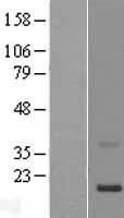 KRTAP11-1 Human Over-expression Lysates NM_175858