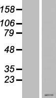 ls337963 krtap23 1 human over expression lysates nm 181624 wb testing 1
