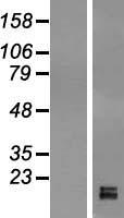 GPIHBP1 Human Over-expression Lysates NM_178172