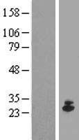 IFNE1 (IFNE) Human Over-expression Lysates NM_176891