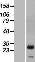RAB7B Human Over-expression Lysates NM_177403