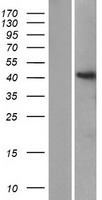 ls338596 st8sia6 human over expression lysates nm 001004470 wb testing 1