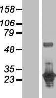 ls338599 dusp27 dupd1 human over expression lysates nm 001003892 wb testing 1