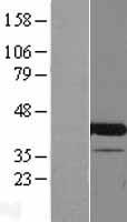 CENATAC Human Over-expression Lysates NM_198489