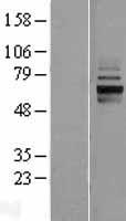 ANKRD13D Human Over-expression Lysates NM_207354