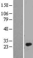 ls338761 c1ql4 human over expression lysates nm 001008223 wb testing 1