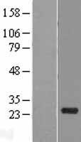 RNS10 (RNASE10) Human Over-expression Lysates NM_001012975