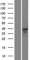 CHX10 (VSX2) Human Over-expression Lysates NM_182894