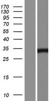 PP14397 (JMJD8) Human Over-expression Lysates NM_001005920