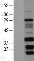 ls339145 cibar2 human over expression lysates nm 198491 wb testing 1