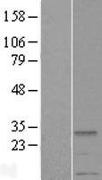 METTL2A Human Over-expression Lysates NM_001005372