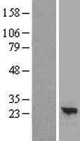 ls339231 arl16 human over expression lysates nm 001040025 wb testing 1