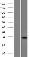 LINC02693 Human Over-expression Lysates NM_001113434