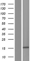 NANOS2 Human Over-expression Lysates NM_001029861