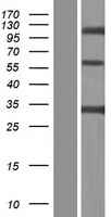 CLEC4G Human Over-expression Lysates NM_198492