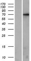 KLHL17 Human Over-expression Lysates NM_198317