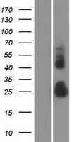 TMEM52 Human Over-expression Lysates NM_178545