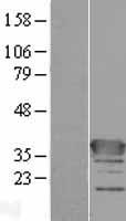 ls339457 c1orf222 human over expression lysates nm 001003808 wb testing 1