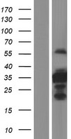 C1orf110 (CCDC190) Human Over-expression Lysates NM_178550