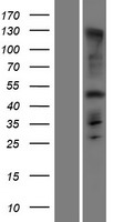 ls339541 armh1 human over expression lysates nm 001145636 wb testing 1