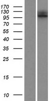 ls339768 espnl human over expression lysates nm 194312 wb testing 1