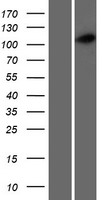 ls339829 ccdc39 human over expression lysates nm 181426 wb testing 1