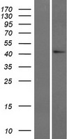 ls339896 gadl1 human over expression lysates nm 207359 wb testing 1