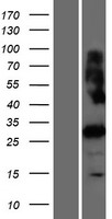 PRSS42P Human Over-expression Lysates NM_182702