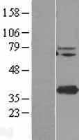 STING (TMEM173) Human Over-expression Lysates NM_198282