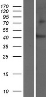 SLC35D3 Human Over-expression Lysates NM_001008783