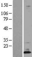 ls340168 dppa5 human over expression lysates nm 001025290 wb testing 1