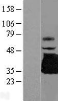 TREML1 Human Over-expression Lysates NM_178174