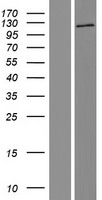ls340351 agbl3 human over expression lysates nm 178563 wb testing 1