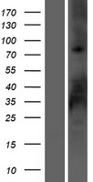 RSPO2 Human Over-expression Lysates NM_178565