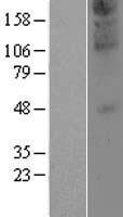 ZDHHC21 Human Over-expression Lysates NM_178566