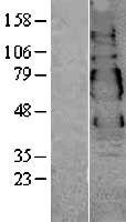 VSIG1 Human Over-expression Lysates NM_182607