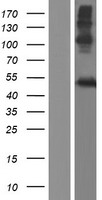 ls340654 lipm human over expression lysates nm 001128215 wb testing 1