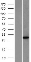 NANOS1 Human Over-expression Lysates NM_199461