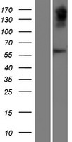 ls341277 ovch2 human over expression lysates nm 198185 wb testing 1
