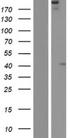 FREM2 Human Over-expression Lysates NM_207361