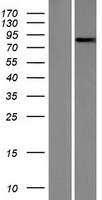 NEK5 Human Over-expression Lysates NM_199289
