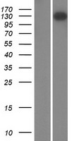 FMN1 Human Over-expression Lysates NM_001103184