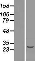 ls342538 naca2 human over expression lysates nm 199290 wb testing 1