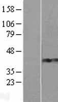 ZNF677 Human Over-expression Lysates NM_182609