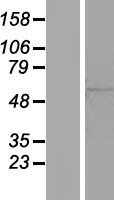 ls342945 znf50 zscan22 human over expression lysates nm 181846 wb testing 1