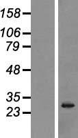 NANOS3 Human Over-expression Lysates NM_001098622