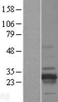 RD3 Human Over-expression Lysates NM_183059